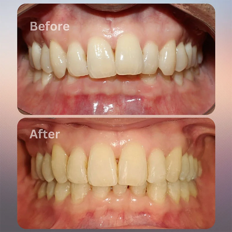 Before-After-04