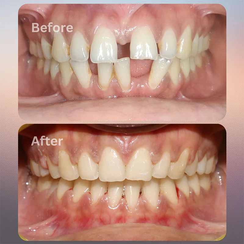 Before-After-05