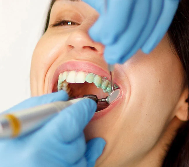 Klinika Dental Clinic_Teeth Cleaning Polishing